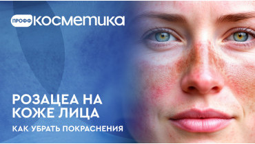 Как убрать покраснения на коже лица